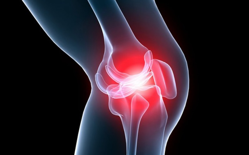 artroza complicată a genunchiului