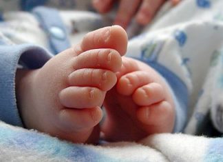 Chirurgie sau gips? Despre piciorul “Varus Equin”, cu doctorul Alexandru Thiery