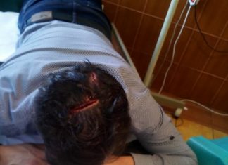 Polițiști răniți la Mangalia, după ce a căzut un panou publicitar!