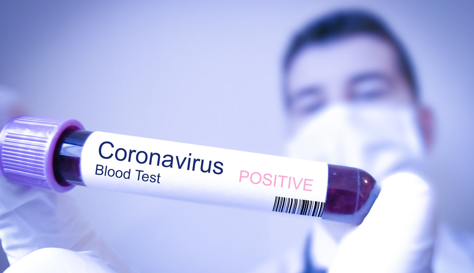 Coronavirus-COVID-19
