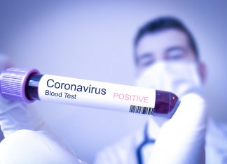 Situație actualizată la nivelul județului Constanța, privind noul coronavirus. Până în prezent, 310 persoane au decedat din rândul celor pozitivate