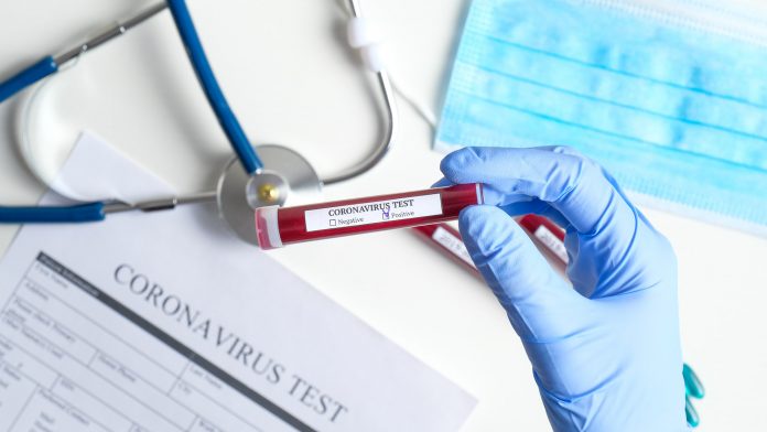 Coronavirus-COVID-19