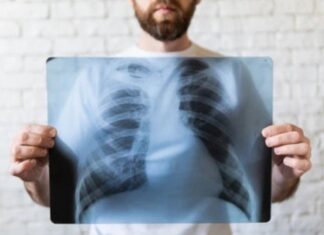 Radiografii pulmonare gratuite pentru locuitorii comunei Limanu